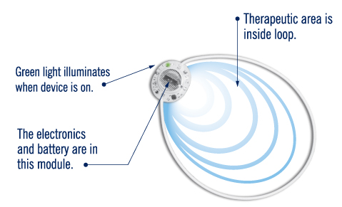 RecoveryRx Device Illustration